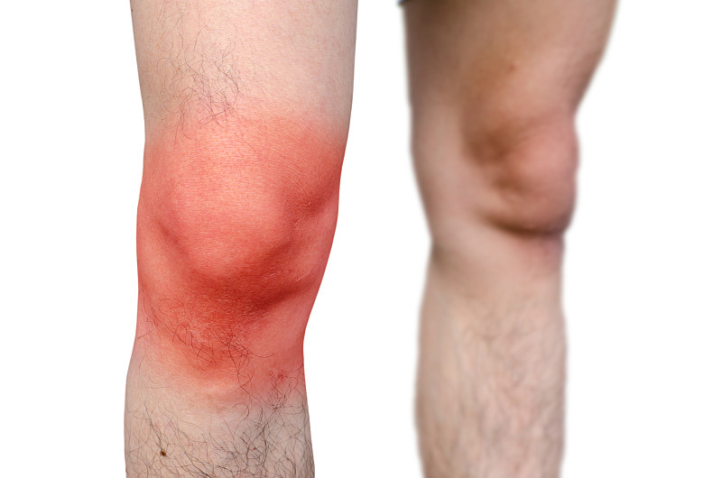 在白色背景下站立的膝蓋疼痛的男人的腹部圖片素材