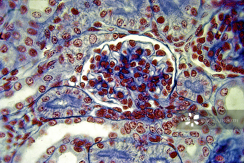 大鼠肾脏的肾小球图片素材