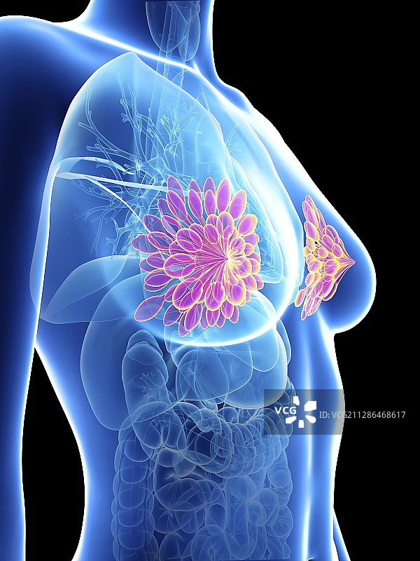 一个女人的乳腺的插图图片素材