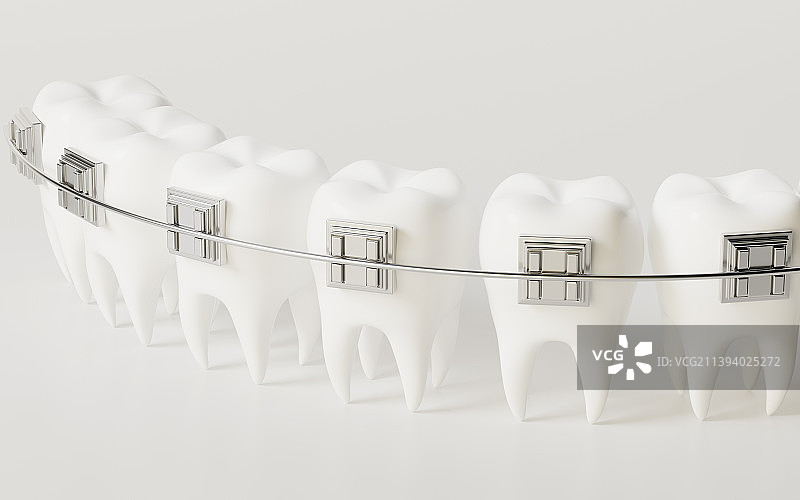 牙齿与牙套，牙齿矫正3D渲染图片素材