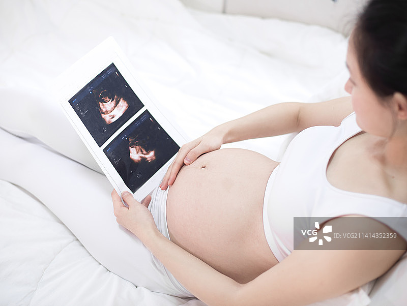 孕妇在查看B超报告图片素材