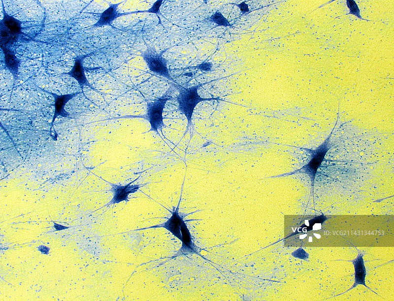 神经细胞，光镜图片素材