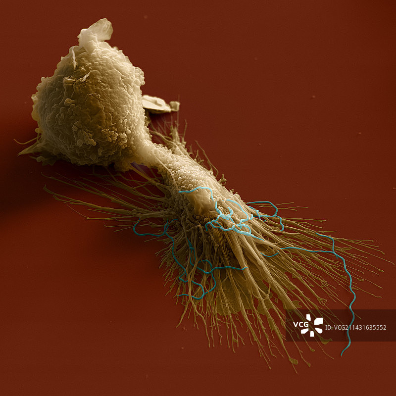 巨噬细胞,扫描电镜图片素材