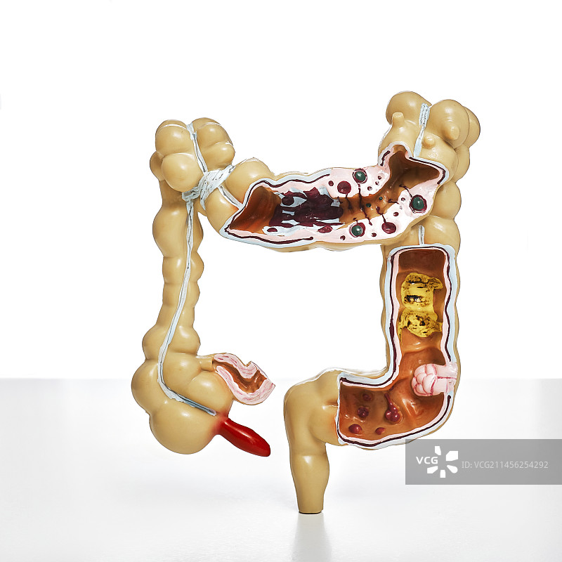 肠道疾病，概念性形象图片素材