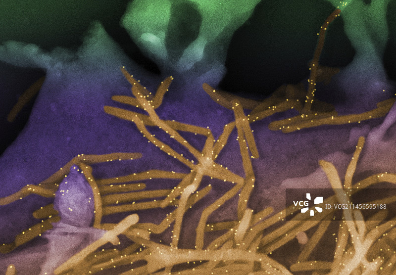 人肺细胞中的RSV病毒颗粒，扫描电镜图片素材