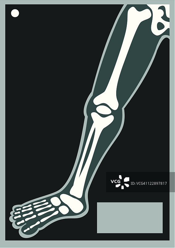 人体X光腿图片素材