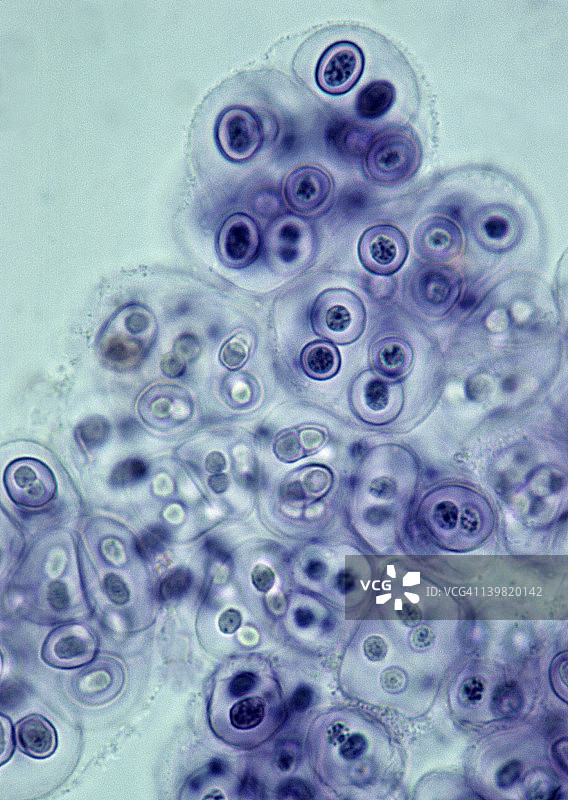 Gloeocapsa，一种蓝藻，光合作用，革兰氏阴性，35mm 100X。以前被称为蓝藻。原核细胞。细胞被胶状物质层层包围。图片素材