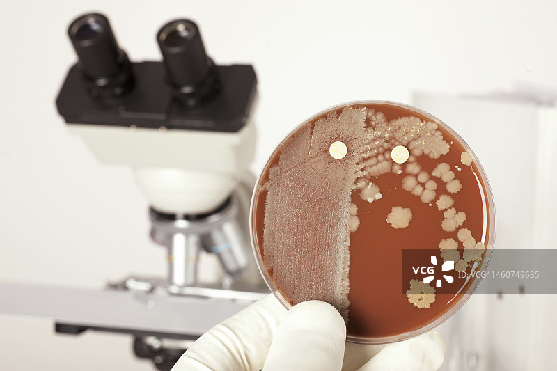 德国，弗莱堡，年轻女子拿着装有细菌的培养皿图片素材