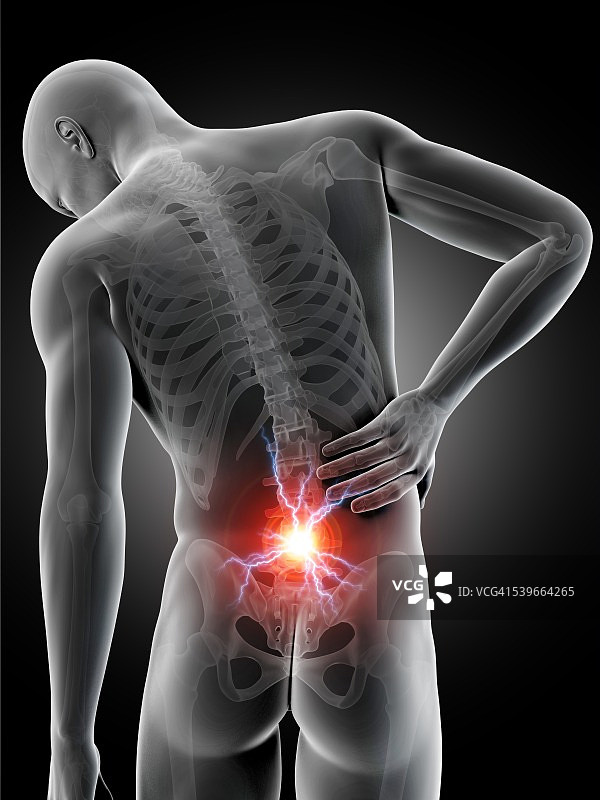 人体背部疼痛，说明图片素材