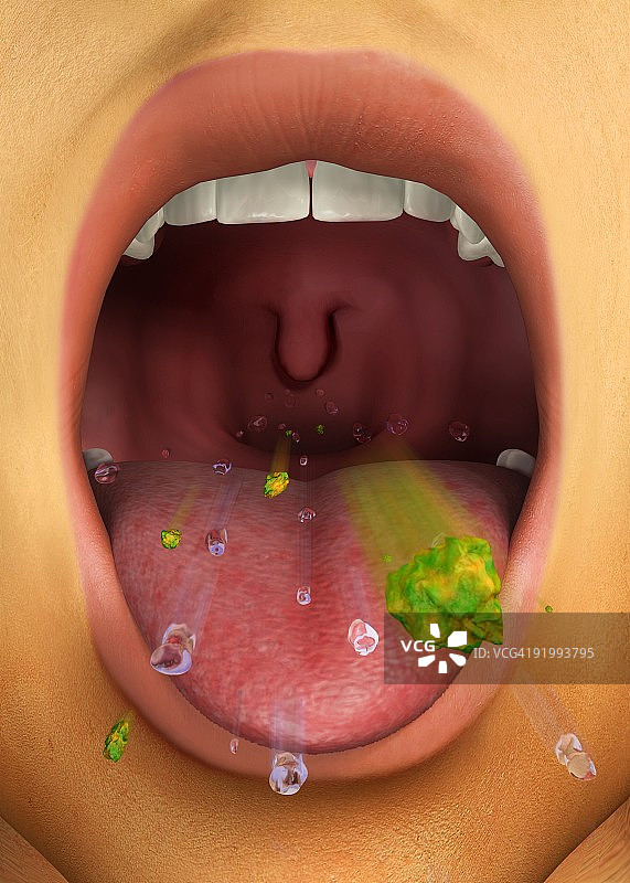 数字插图显示咳嗽反射行动通过张开的嘴图片素材