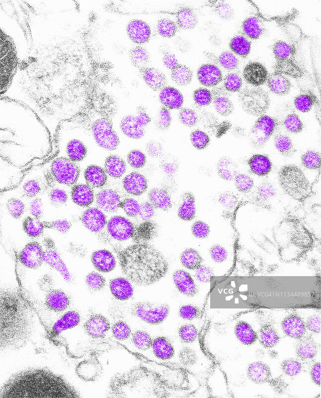 TEM的冠状病毒图片素材