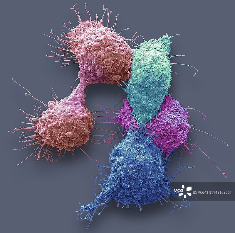 卵巢癌细胞，扫描电镜图片素材