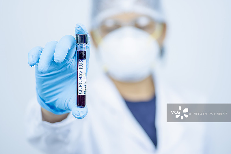 医生或实验室技术员拿着血样图片素材