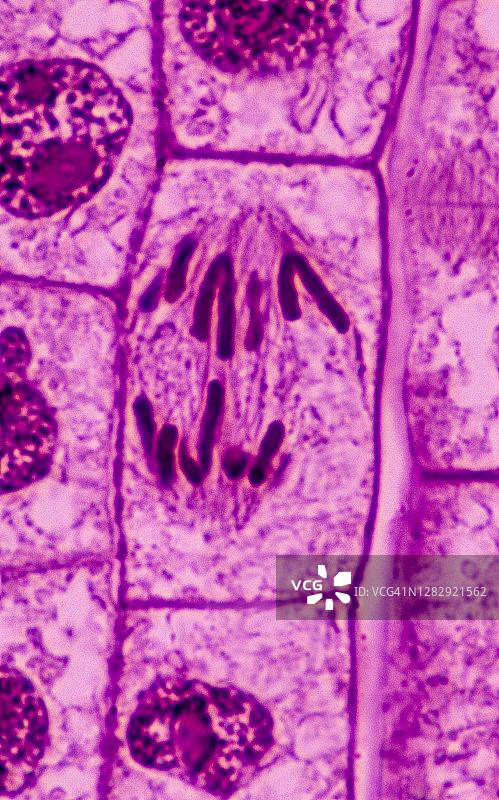 植物细胞分裂(有丝分裂)，后期，洋葱(葱)根尖，400X图片素材