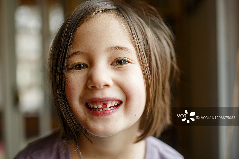 一个骄傲的小女孩的特写，展示失去的牙齿与大大的微笑图片素材