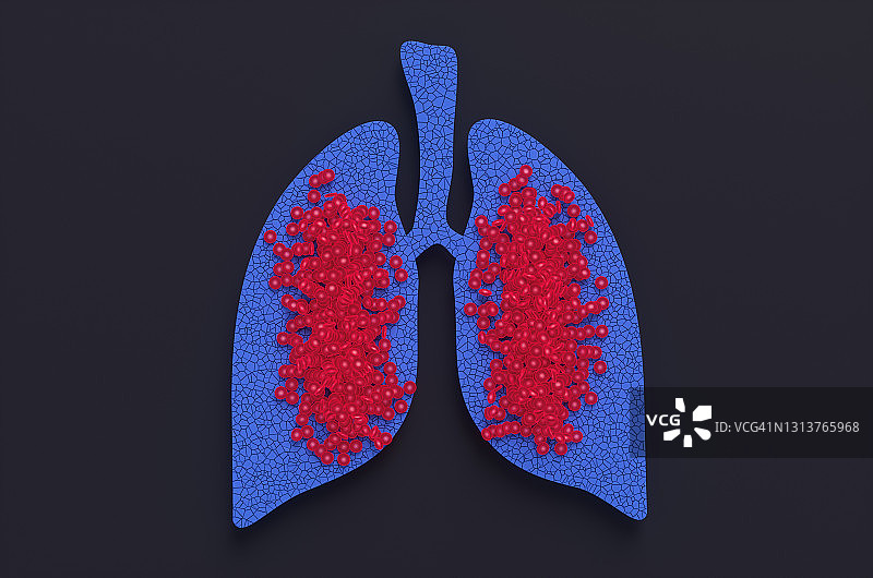 一个被破坏的人类肺部模型的特写，红色的血细胞映衬着黑色的背景。感染冠状病毒的肺部。3 d渲染图图片素材
