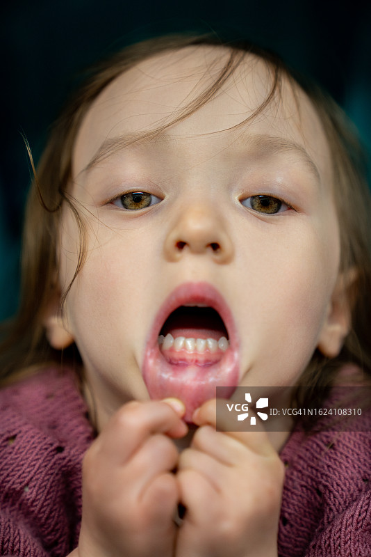 一个孩子为她的牙齿和牙龈感到骄傲图片素材