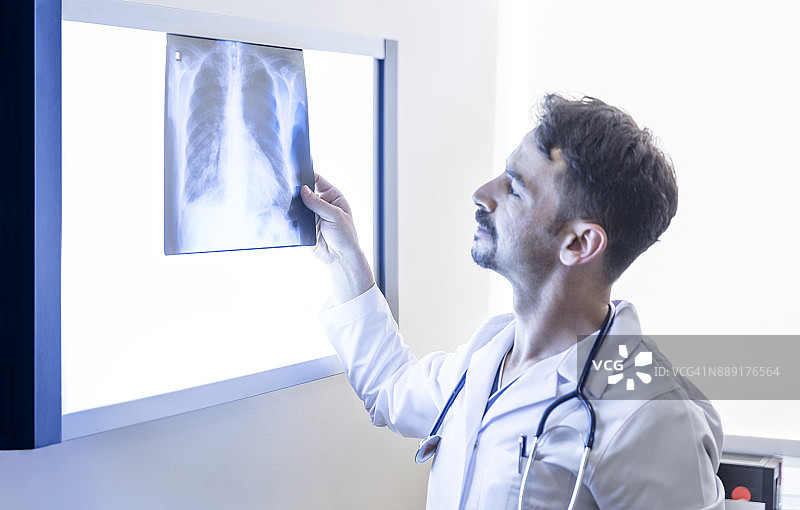 医生在看肺的x光片图片素材
