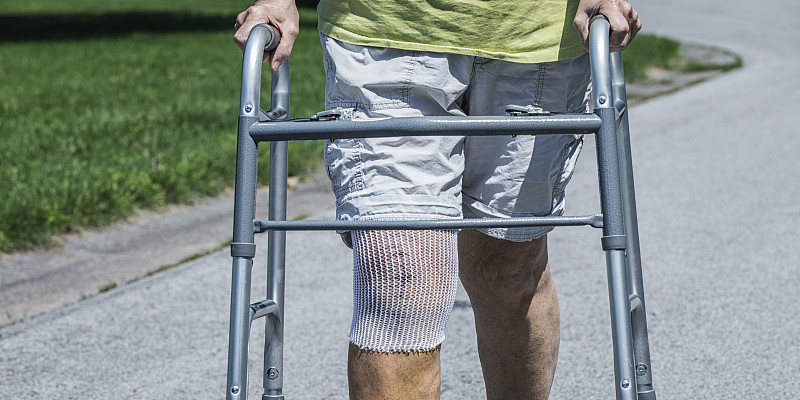膝关节置换手术病人特写图片下载