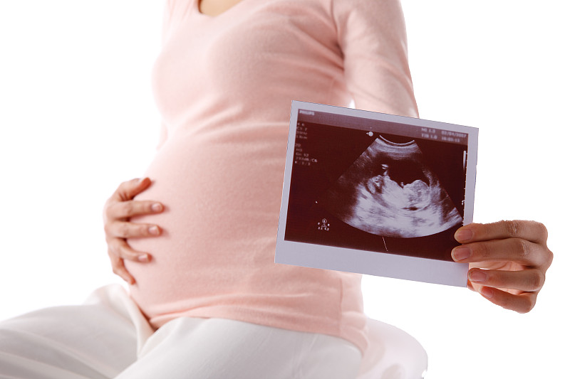 孕妇手拿超声波照片摄影图片下载