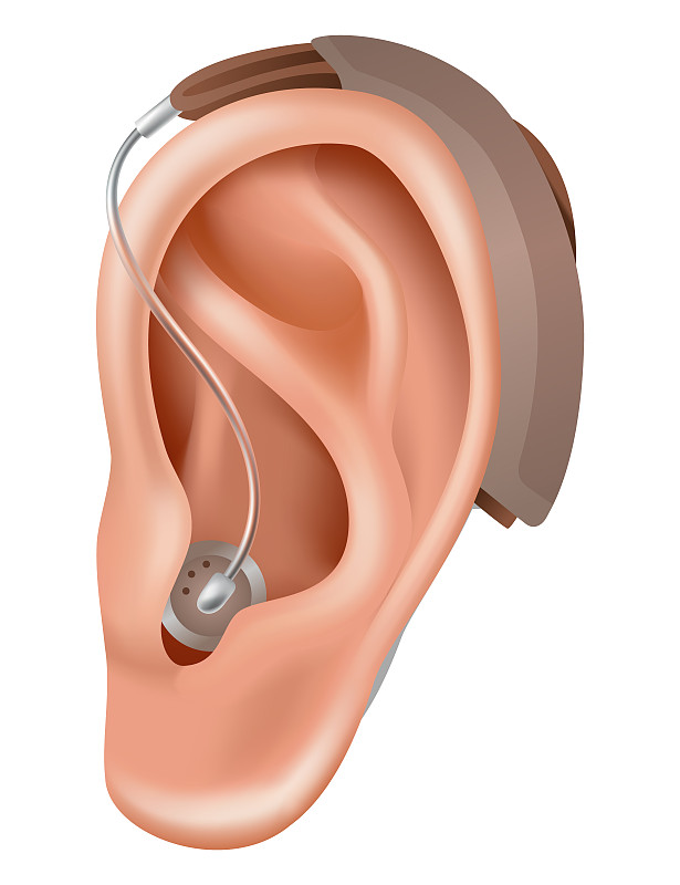 助听器。听力损失患者的扩音器。医药卫生。耳后的真实物体。耳鼻喉科治疗与义肢图片下载