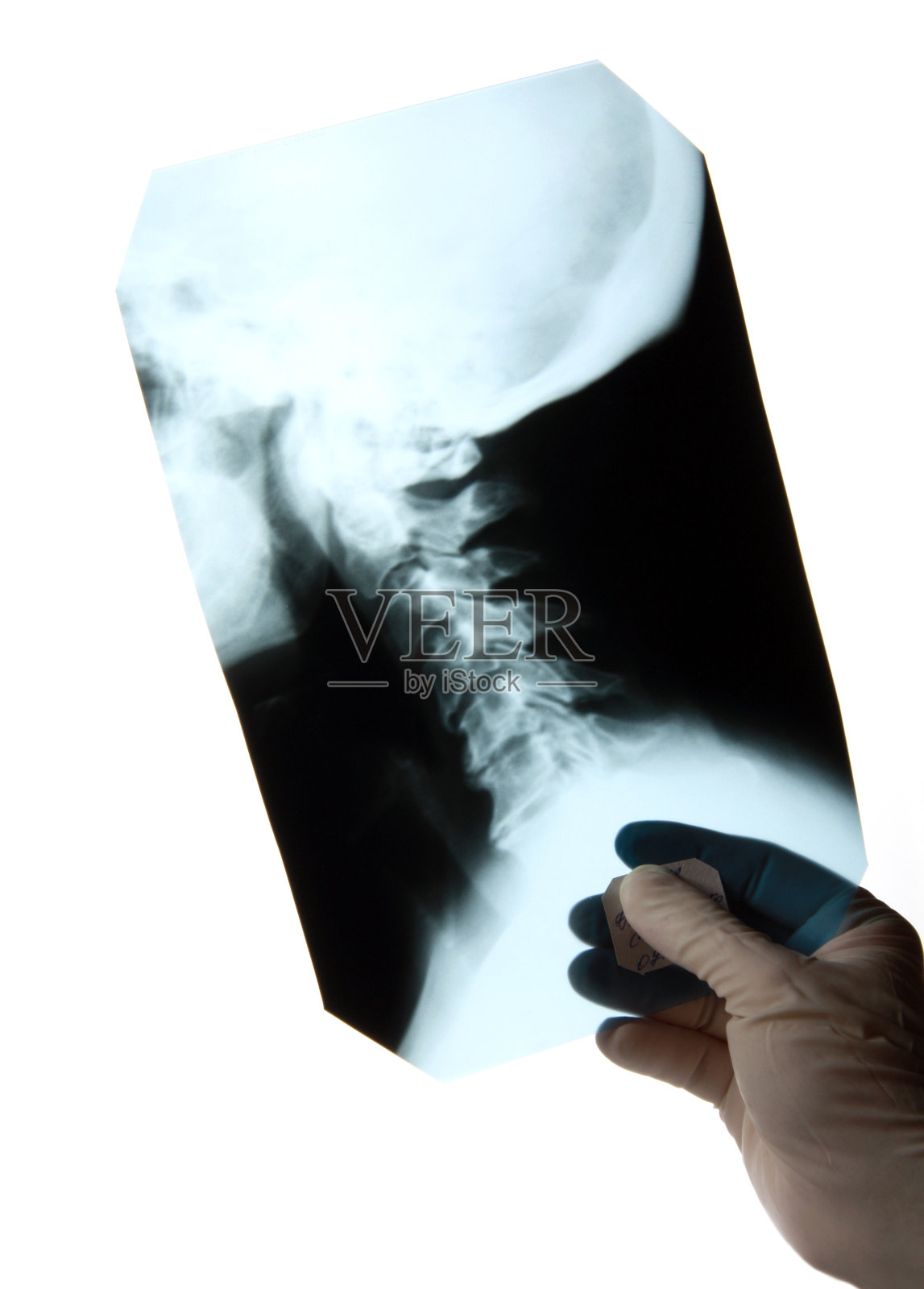 颈椎x光片照片摄影图片