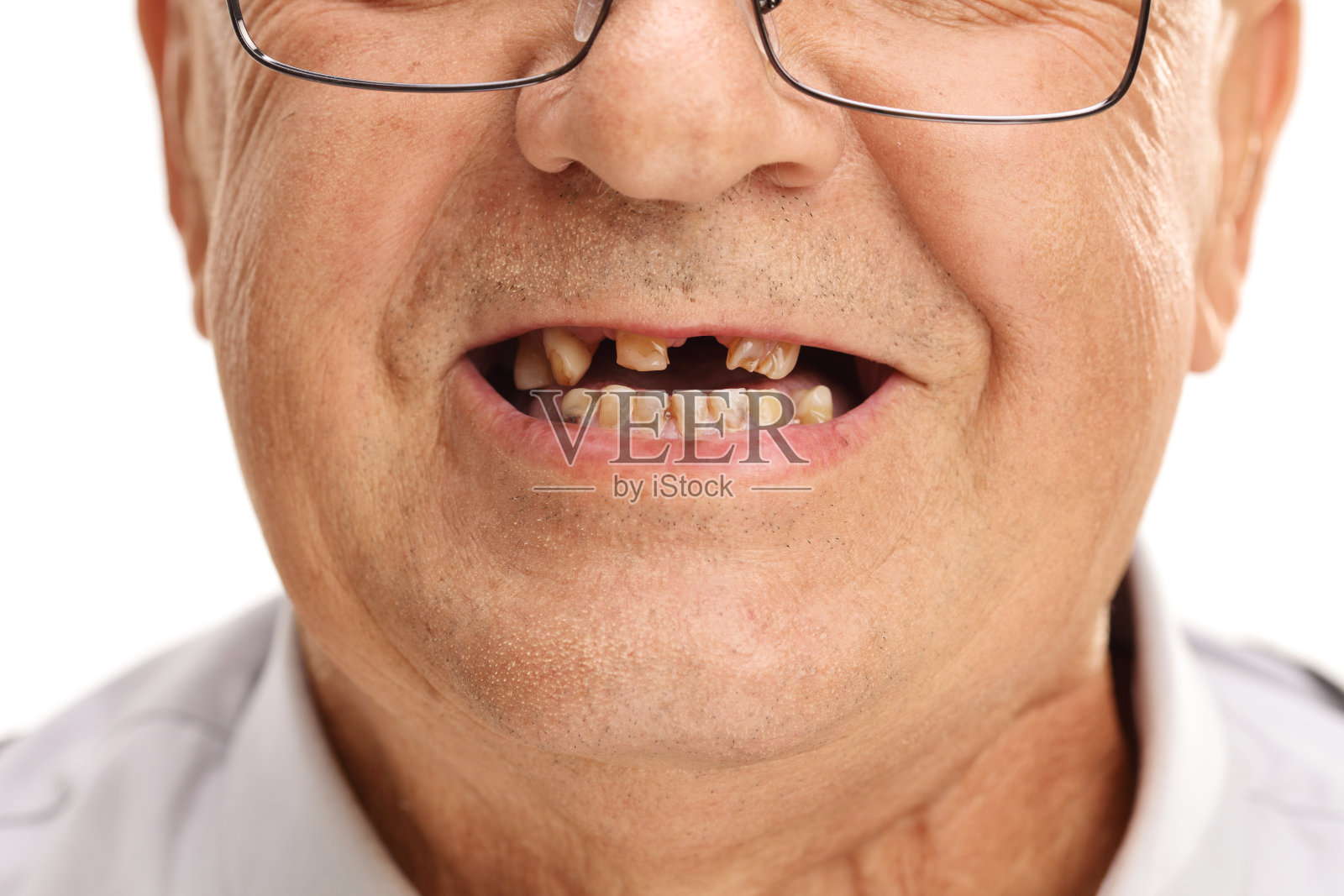 一个断牙的大四学生的嘴照片摄影图片
