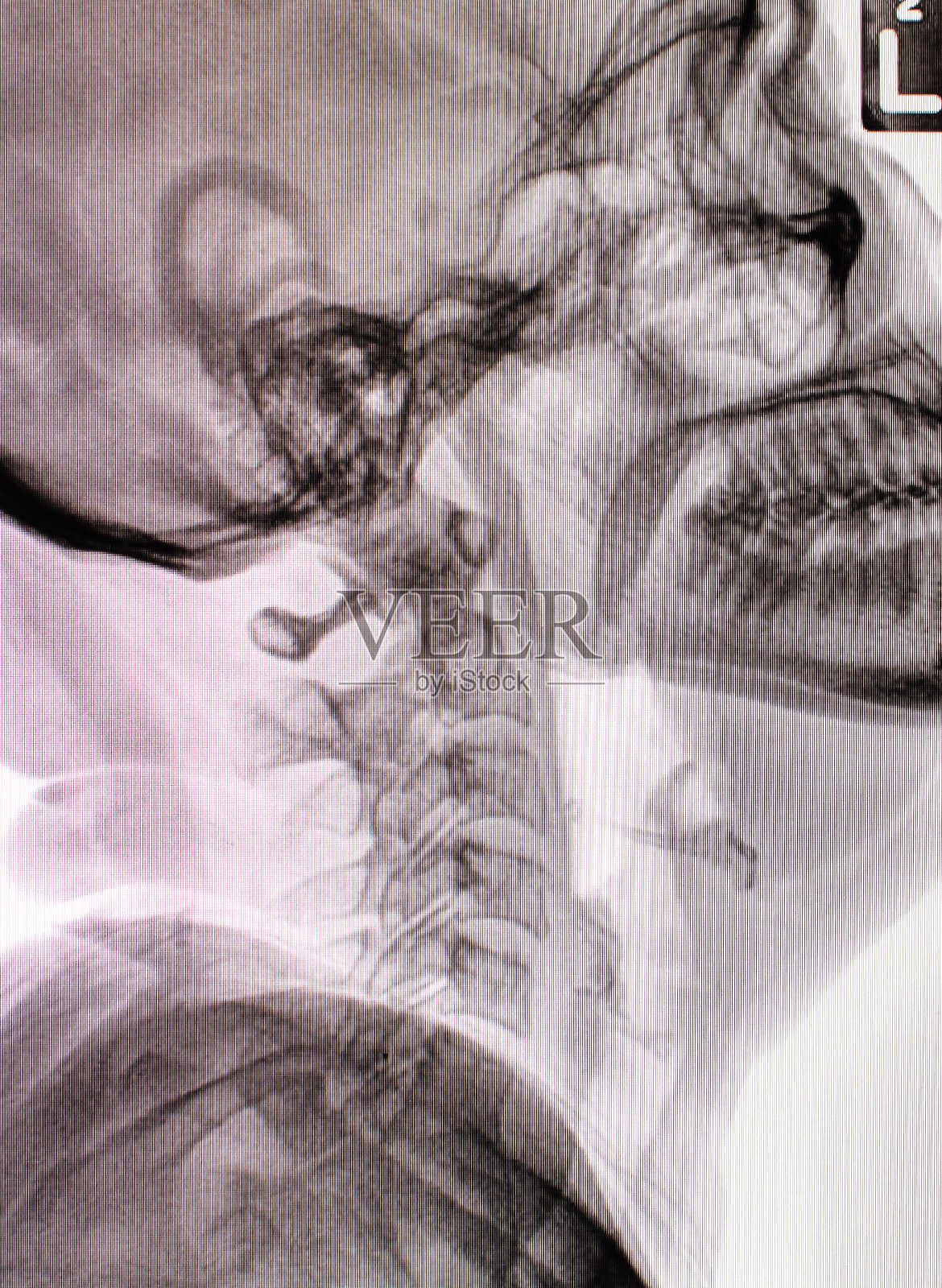 颈椎x光照片摄影图片