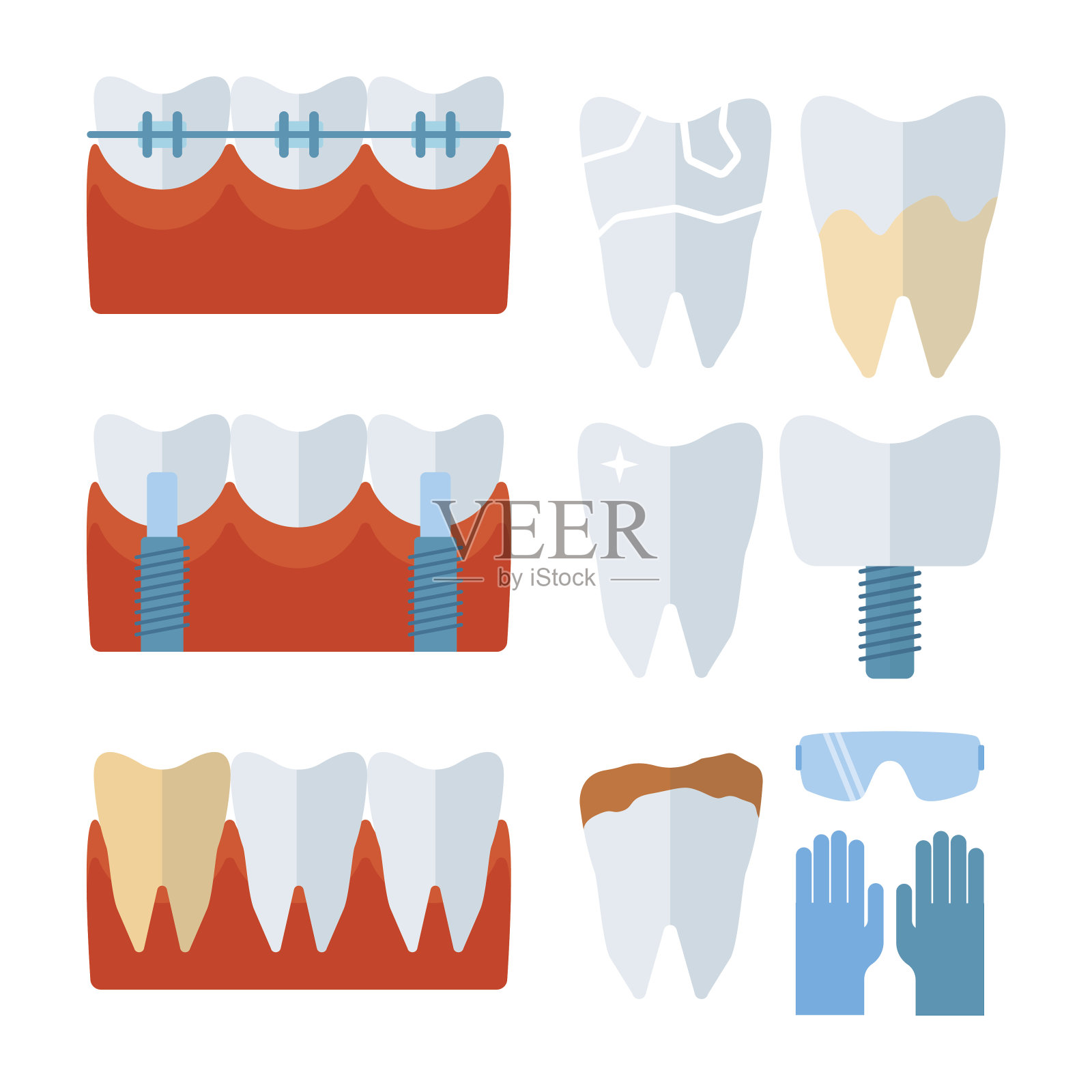 牙医牙齿种植和口腔医学设备矢量插图。插画图片素材