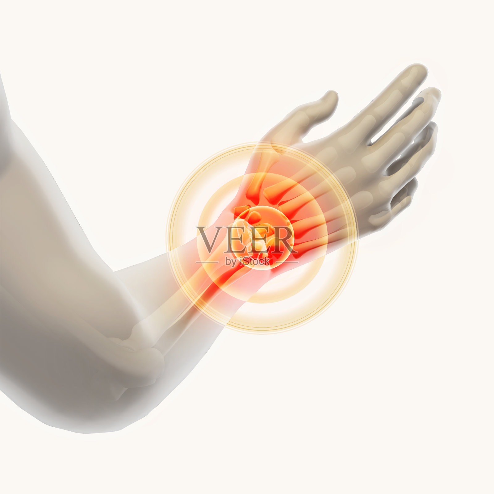 手腕疼痛-骨骼x光片。插画图片素材