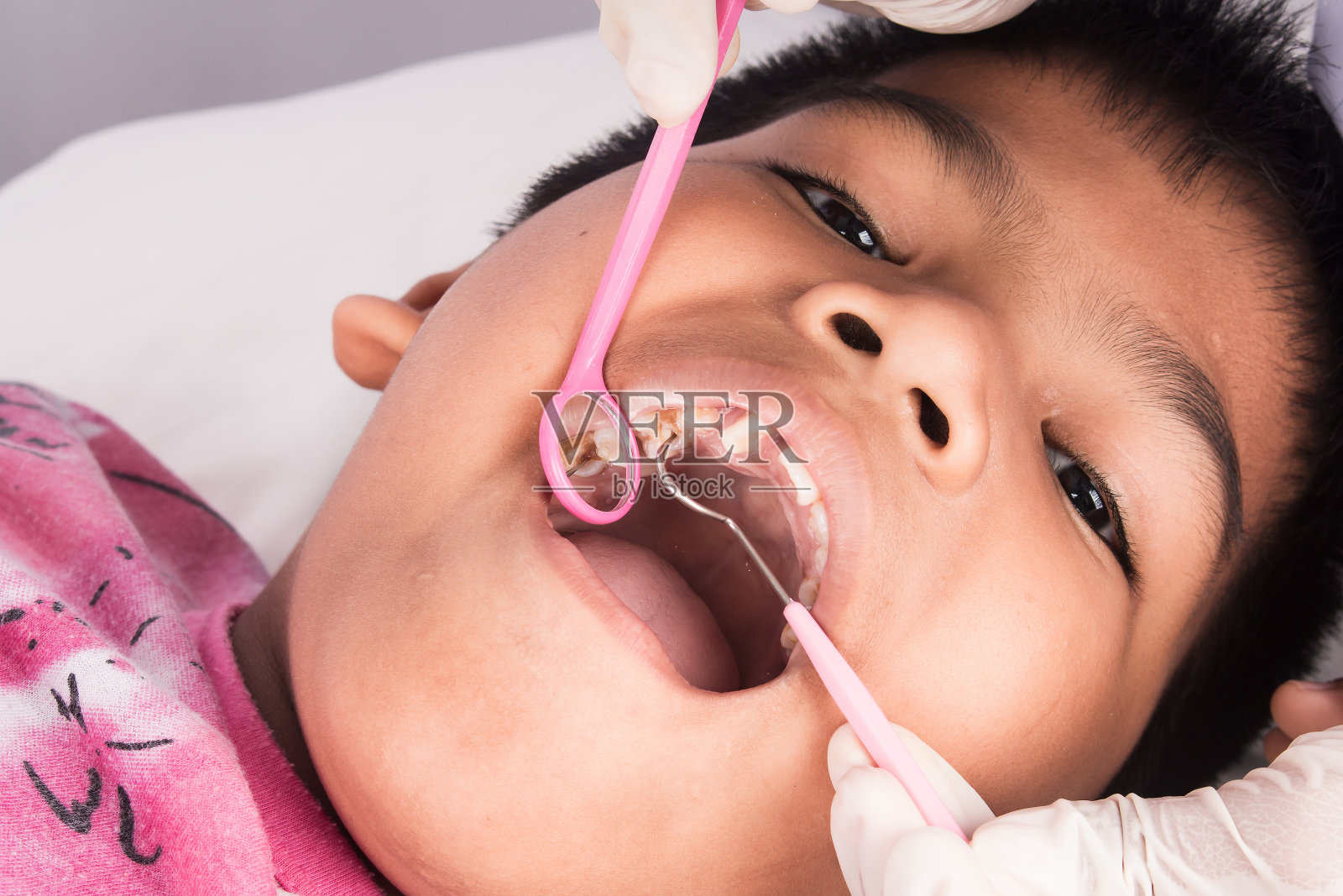 牙齿男孩的近距离检查由牙医照片摄影图片