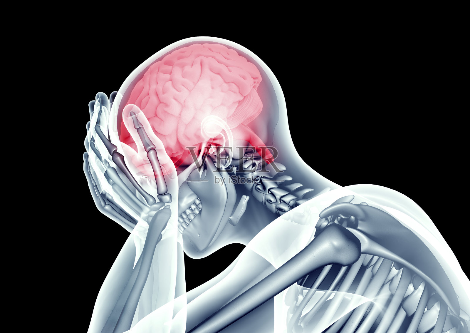 人类头部疼痛的x光图像照片摄影图片