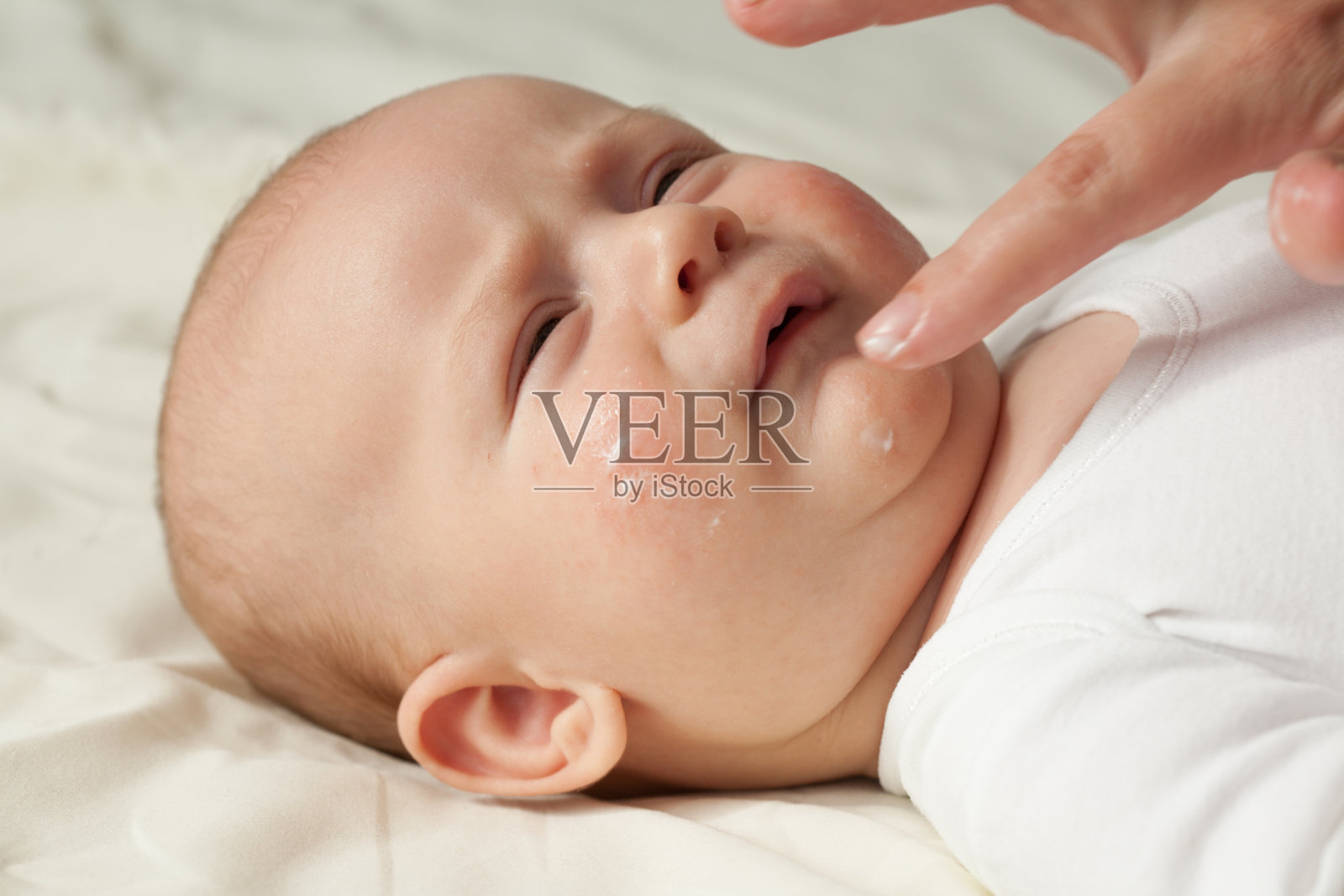 患有特应性皮炎的宝宝正在涂护肤霜照片摄影图片