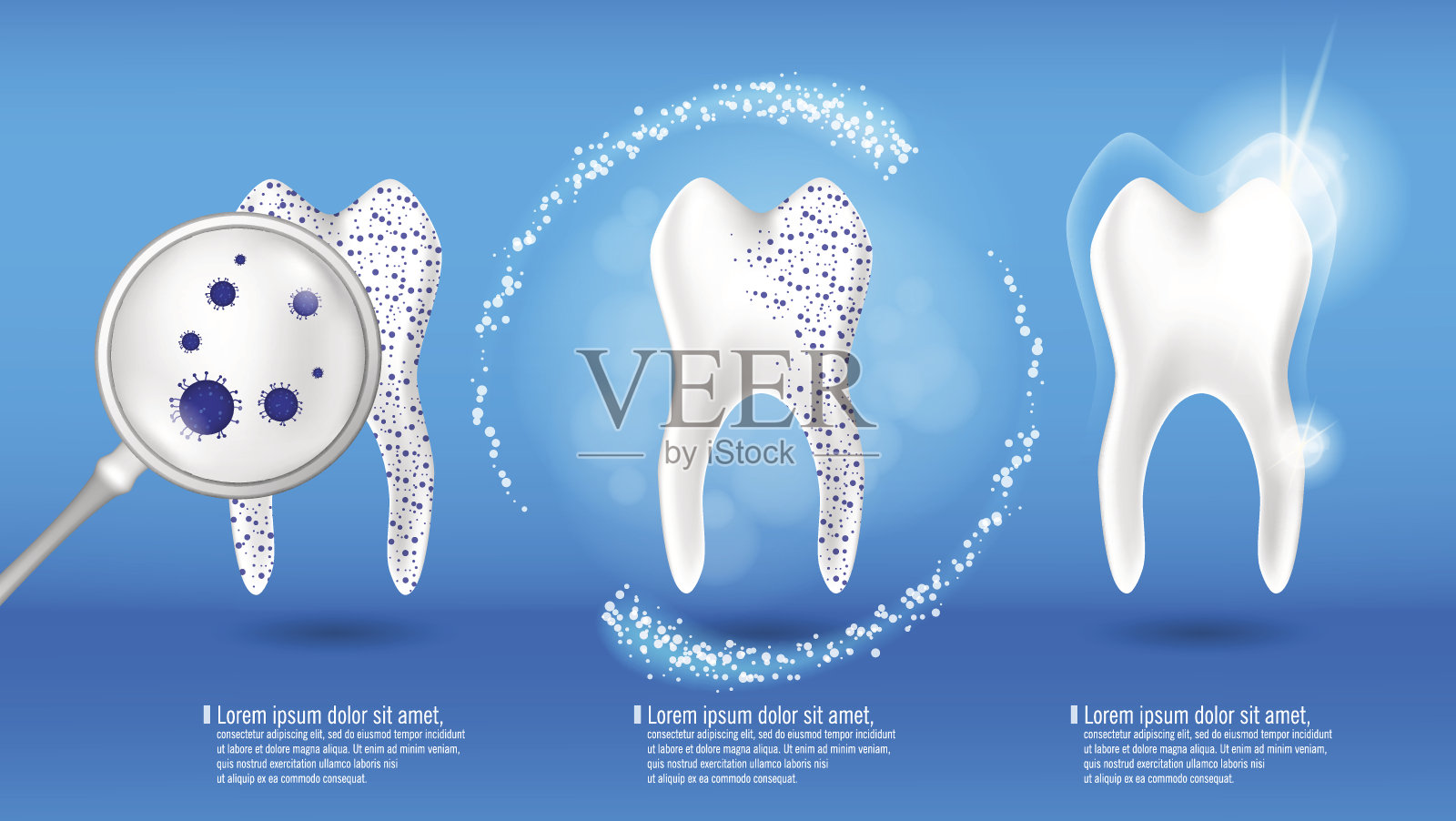 口腔护理和牙齿健康概念。闪亮清洁和脏牙在蓝色背景上，清除牙齿过程。牙齿美白修复。矢量图插画图片素材