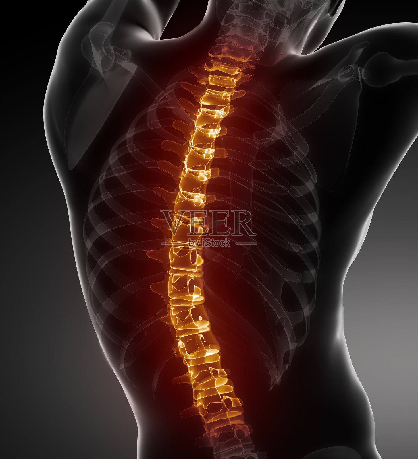 脊柱问题-医学后视图照片摄影图片
