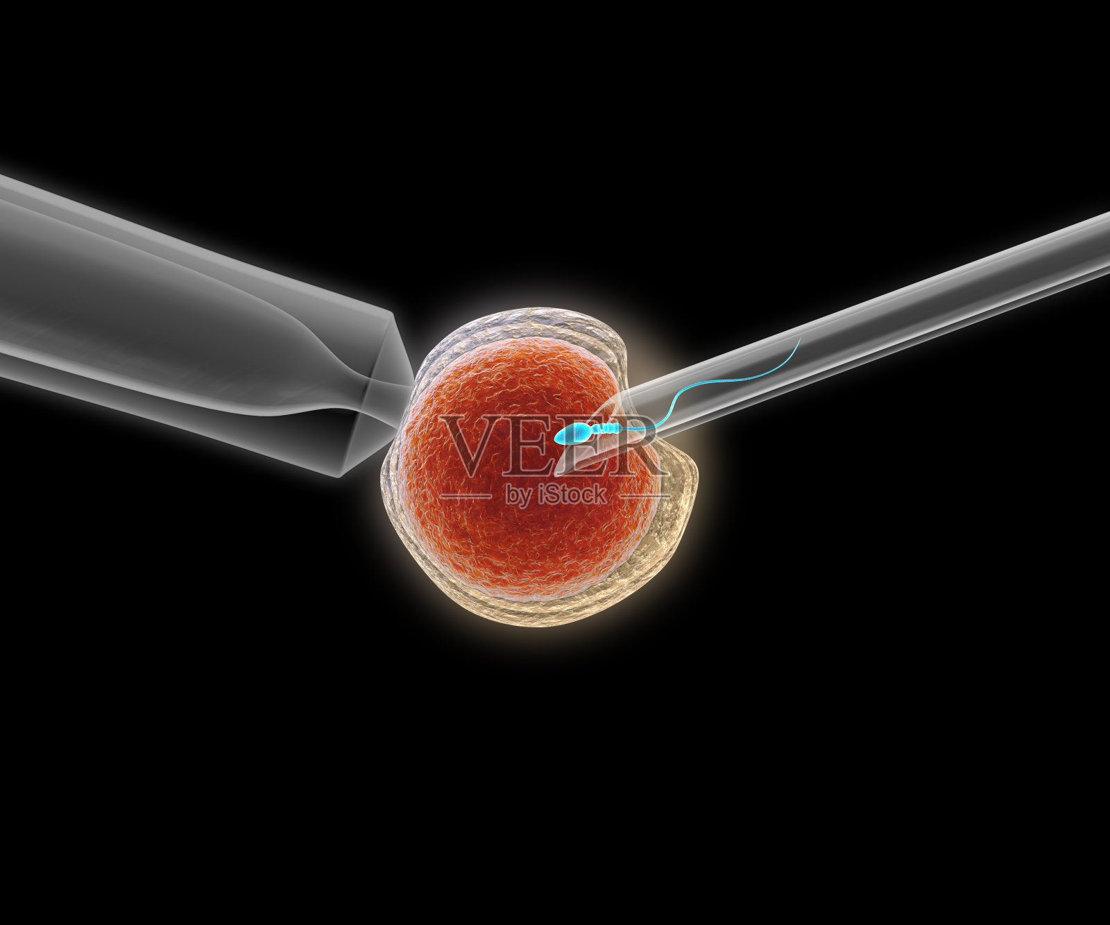 icsi(胞浆内精子注射)过程的3D插图——将单个精子直接注射到卵子中照片摄影图片