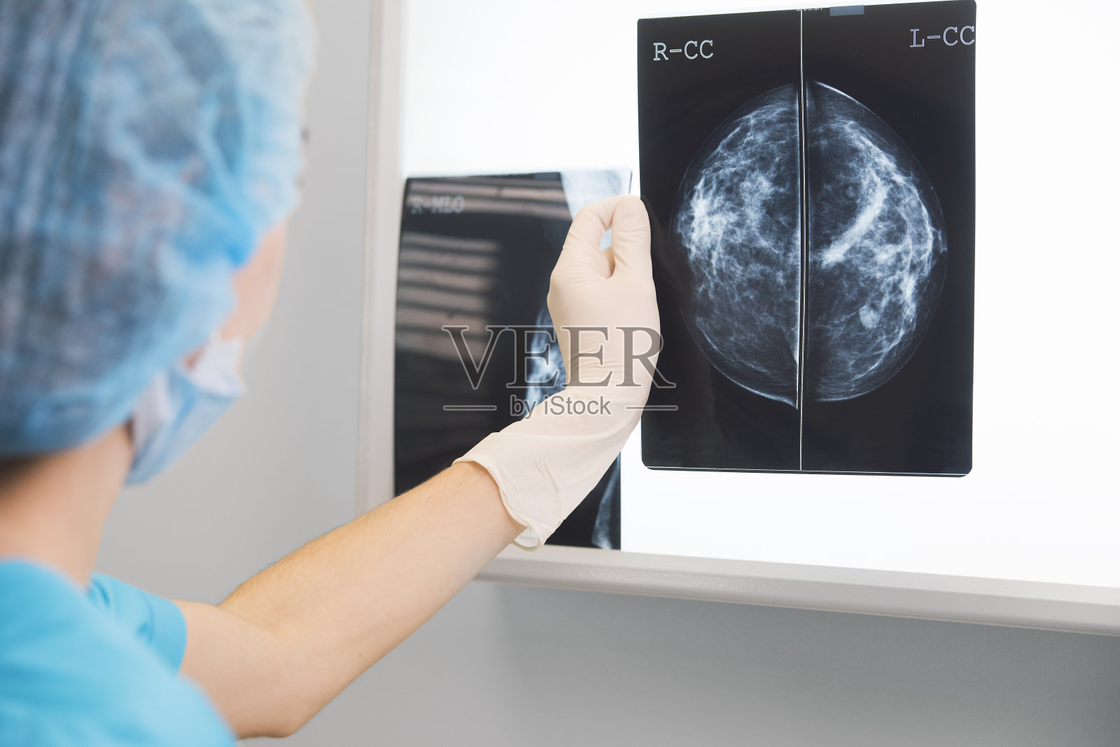 身着手术服的女医生或护士正拿着一张乳房x光片站在x光照明灯前照片摄影图片