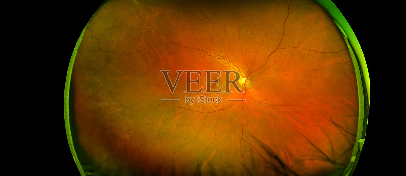 伴有黄斑、血管和视盘的视网膜角度图像照片摄影图片