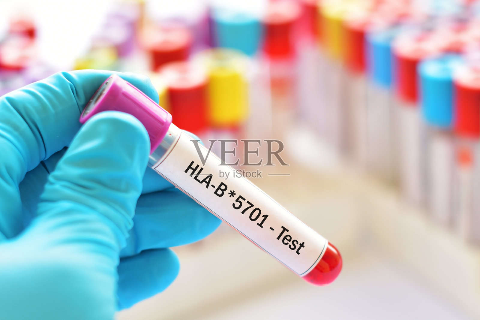 HLA-B*5701检测血样照片摄影图片