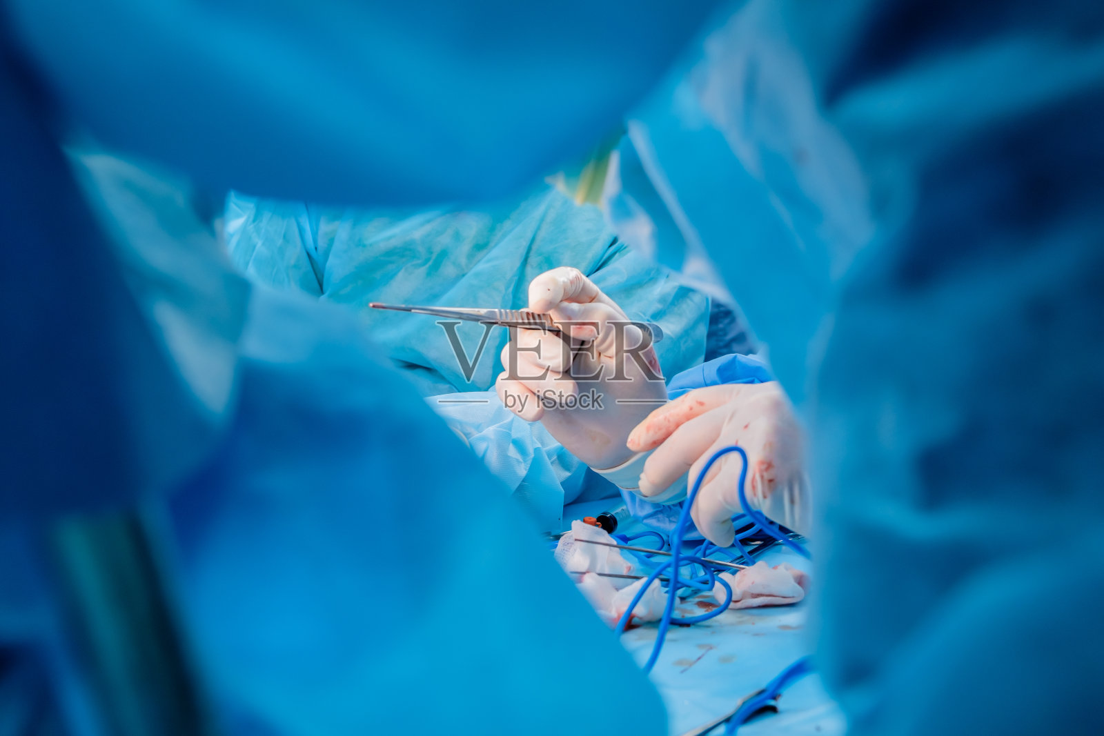 外科医生手上沾满血迹戴着无菌乳胶手套手术器械上有血迹。手术。照片摄影图片