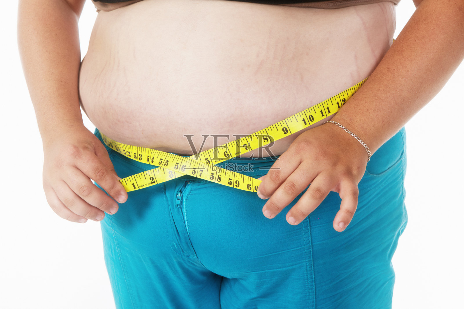 一名肚子上有妊娠纹的超重年轻女子用卷尺量腰围照片摄影图片